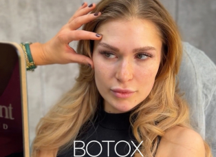 botox