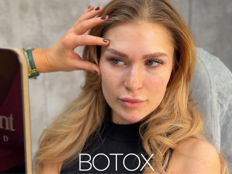 botox