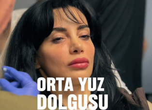 dolgu