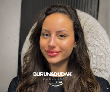burun dolgusu