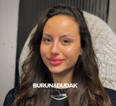 burun ve dudak dolgusu