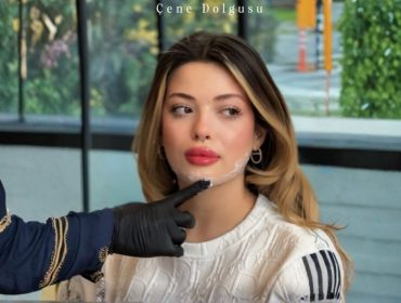 çene dolgusu
