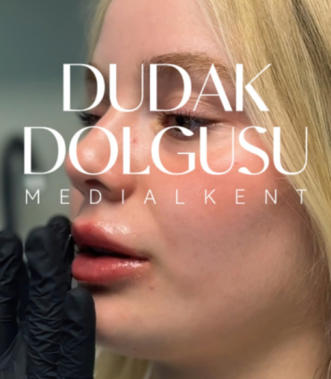 dolgu