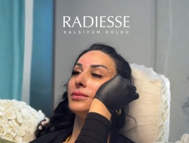 radiesse