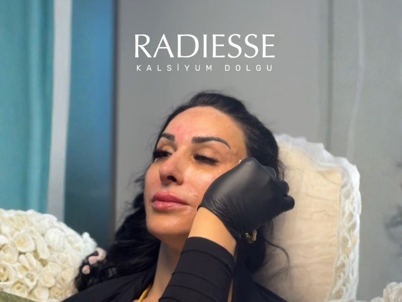 radiesse