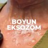 eksozom
